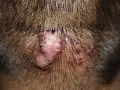 Lesión cutánea inflamada con pelos incrustados, similar a granos en el cuello, en la nuca.
