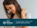 Mujer con expresión de incomodidad, tocándose el brazo. El texto indica "10 claves para cuidar tu piel cuando tienes psoriasis".