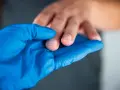 Manos con callos, examinadas con guante azul.