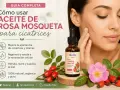 Guía completa: cómo usar aceite de rosa mosqueta para cicatrices. Mejora, regenera e hidrata la piel.