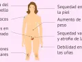 Ilustración de síntomas de menopausia: caída de cabello, sofocos, sequedad de piel, aumento de peso, etc. Testimonios menopausia.