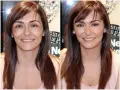 Comparación de piel cetrina antes y después de tratamiento. La imagen de la izquierda muestra manchas y tono desigual, mientras que la de la derecha revela una piel radiante y uniforme.