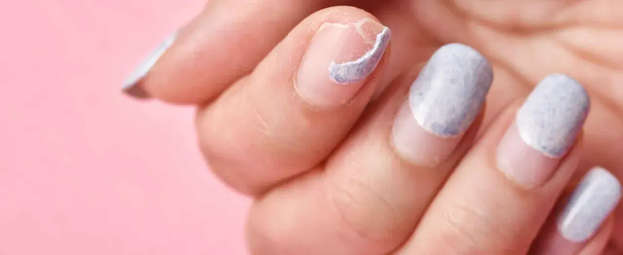 Mano con uñas descascaradas y dañadas, mostrando la necesidad de regenerar uñas dañadas para una apariencia saludable.