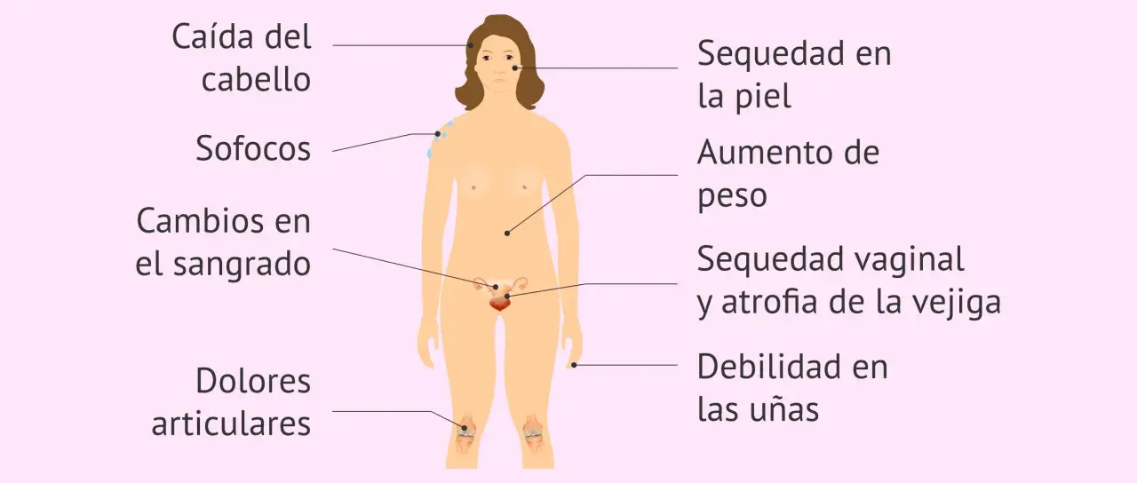 Ilustración de síntomas de menopausia: caída de cabello, sofocos, sequedad de piel, aumento de peso, etc. Testimonios menopausia.