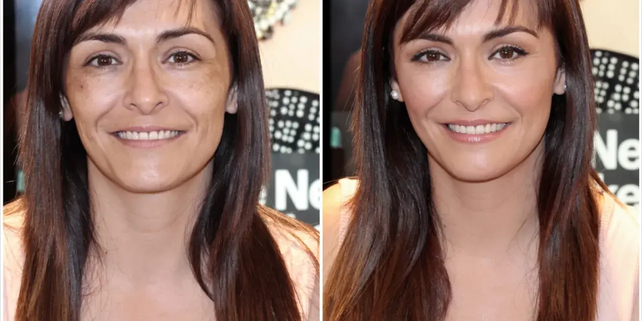 Comparación de piel cetrina antes y después de tratamiento. La imagen de la izquierda muestra manchas y tono desigual, mientras que la de la derecha revela una piel radiante y uniforme.