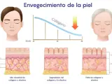Gráfico muestra cómo disminuye el colágeno con la edad. ¿A qué edad se puede tomar colágeno? A partir de los 20 años, la piel pierde colágeno.