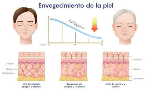 Gráfico muestra cómo disminuye el colágeno con la edad. ¿A qué edad se puede tomar colágeno? A partir de los 20 años, la piel pierde colágeno.