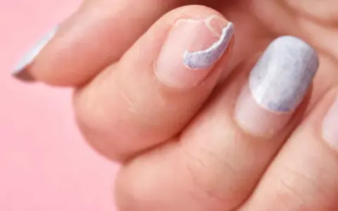 Mano con uñas descascaradas y dañadas, mostrando la necesidad de regenerar uñas dañadas para una apariencia saludable.