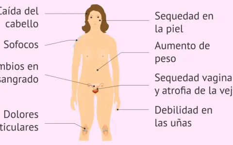 Ilustración de síntomas de menopausia: caída de cabello, sofocos, sequedad de piel, aumento de peso, etc. Testimonios menopausia.