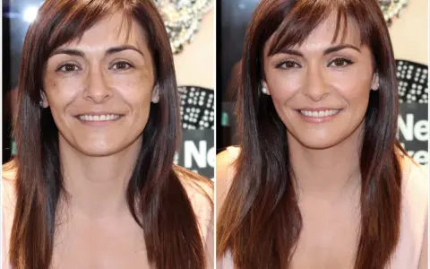 Comparación de piel cetrina antes y después de tratamiento. La imagen de la izquierda muestra manchas y tono desigual, mientras que la de la derecha revela una piel radiante y uniforme.