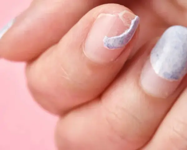 Mano con uñas descascaradas y dañadas, mostrando la necesidad de regenerar uñas dañadas para una apariencia saludable.