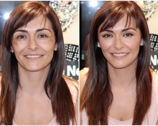Comparación de piel cetrina antes y después de tratamiento. La imagen de la izquierda muestra manchas y tono desigual, mientras que la de la derecha revela una piel radiante y uniforme.