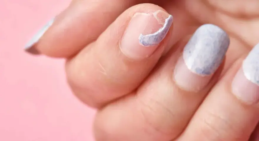 Mano con uñas descascaradas y dañadas, mostrando la necesidad de regenerar uñas dañadas para una apariencia saludable.