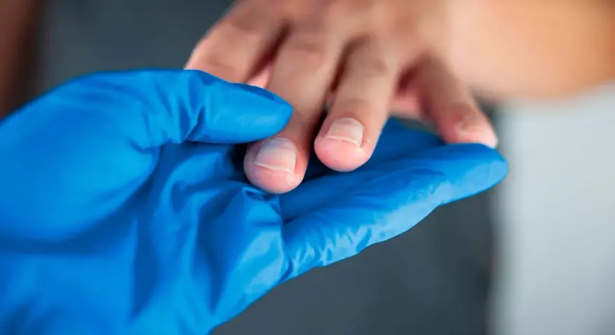 Manos con callos, examinadas con guante azul.