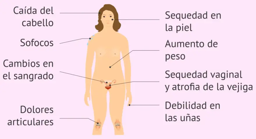 Ilustración de síntomas de menopausia: caída de cabello, sofocos, sequedad de piel, aumento de peso, etc. Testimonios menopausia.