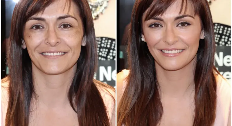 Comparación de piel cetrina antes y después de tratamiento. La imagen de la izquierda muestra manchas y tono desigual, mientras que la de la derecha revela una piel radiante y uniforme.